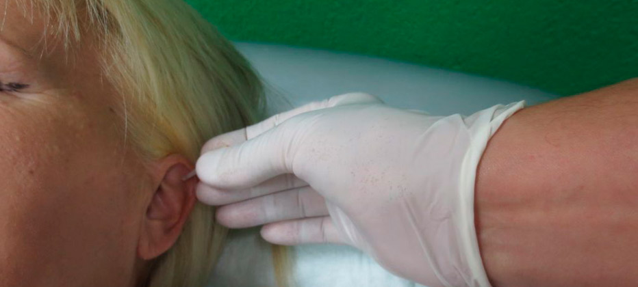 tratamiento de parkinson granada