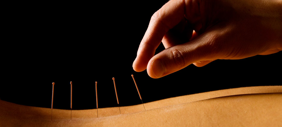 que es la medicina de acupuntura