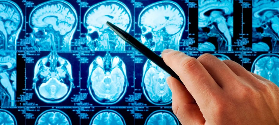 alzheimertest 10 fragen