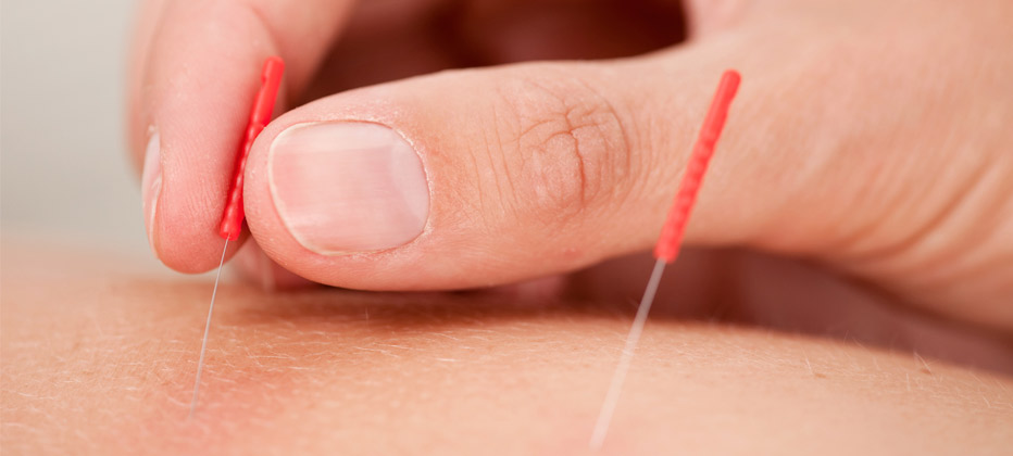 acupuntura para enfermedades neurologicas