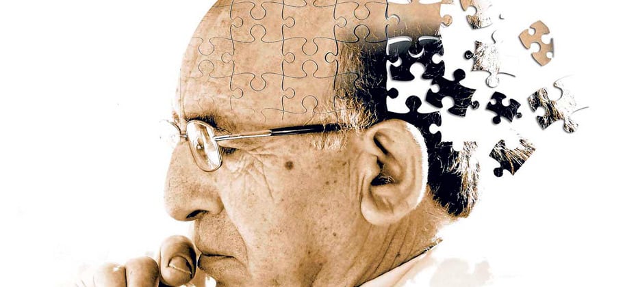 der unterschied zwischen alzheimer und seniler demenz