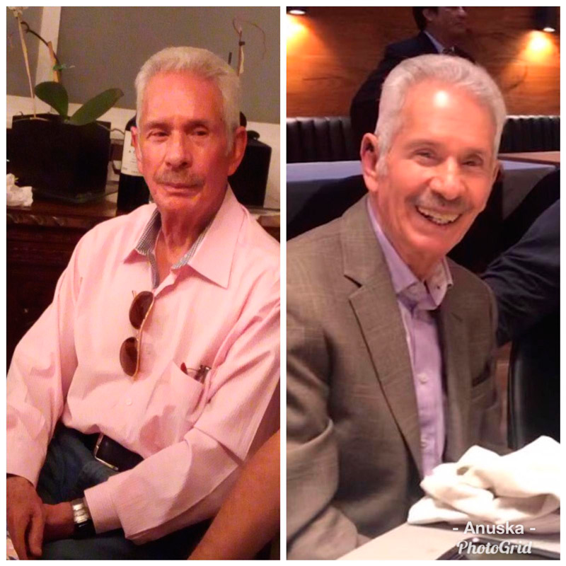 foto antes despues paciente parkinson enrique