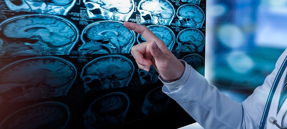 que es la camara hiperbarica