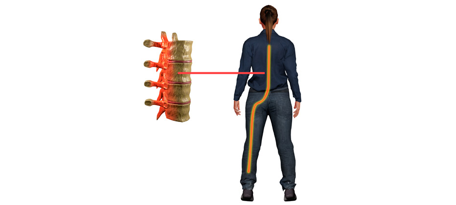 auriculoterapia nervio ciatico