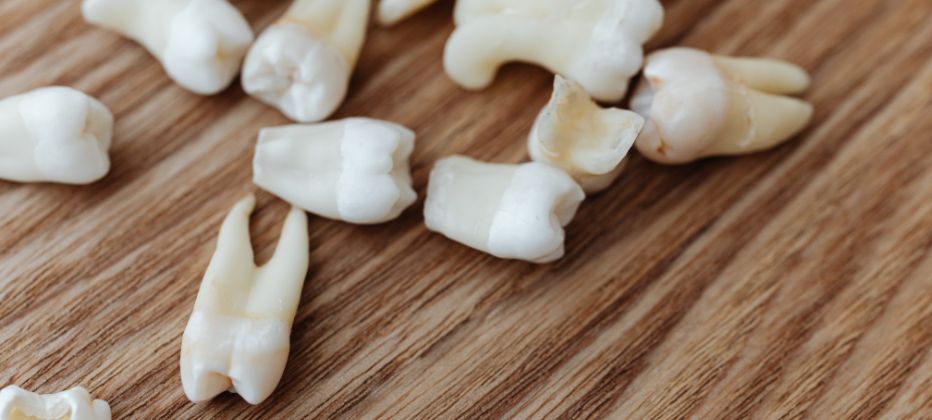 perdida dientes alzheimer