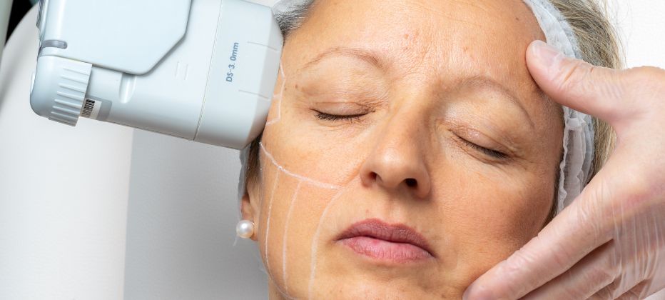 propiedades del tratamiento hifu