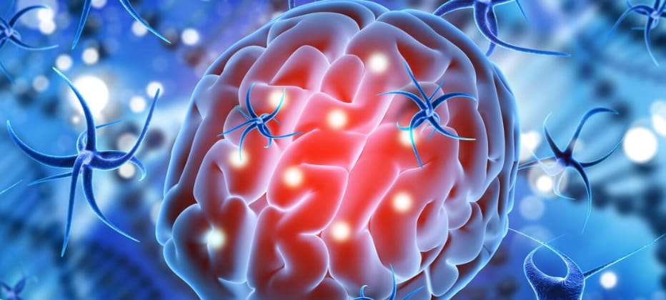 dana el parkinson la sustancia negra