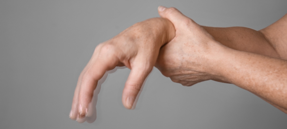 alfa-sinuncleina-parkinson