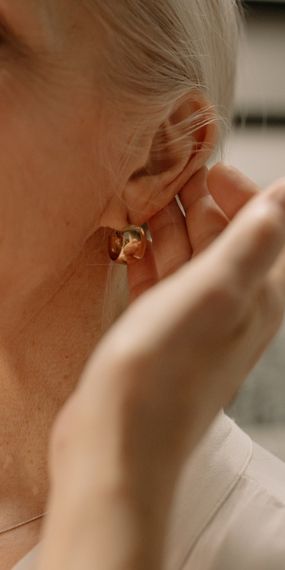 acupuntura semipermanente